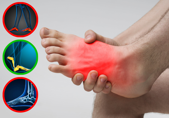 Fußfehlstellungen: 5 Tipps für die Fußgesundheit