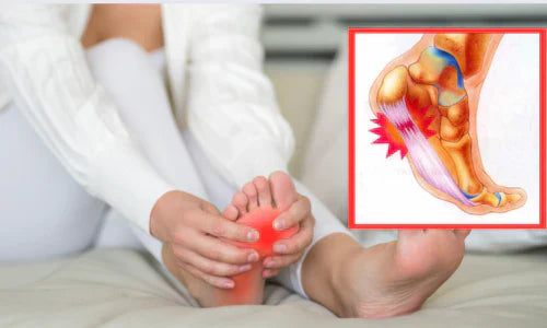 Plantarfasziitis als Problem? Verschwenden Sie nicht Ihre Zeit mit Dehnübungen – Sie könnten es sogar verschlimmern…
