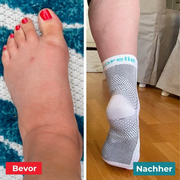 StepEase – Tschüss, Fußschmerzen!
