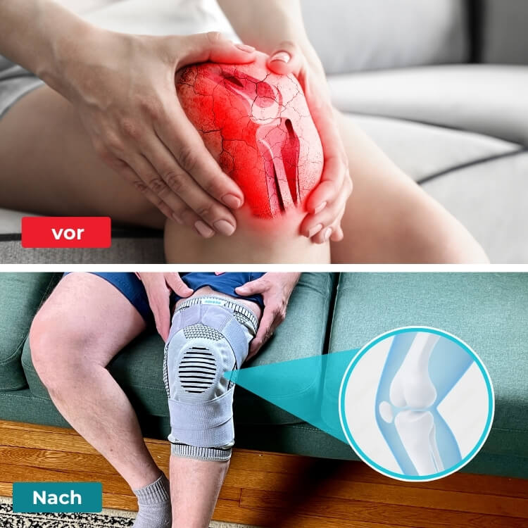 AktivLife 2.0 – neue Kniebandage
